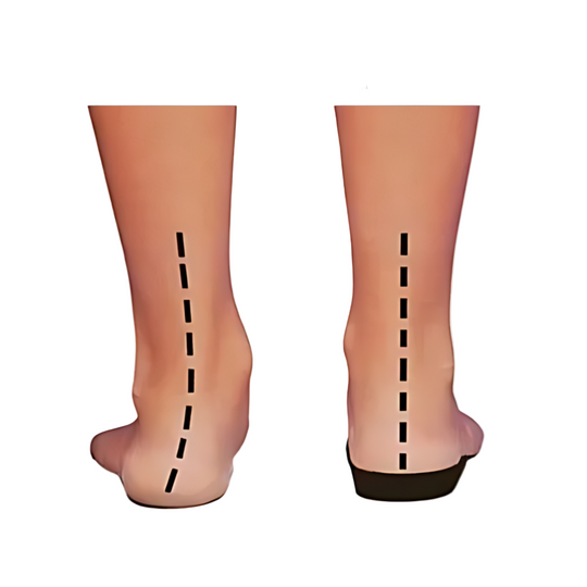 Damen Sneaker mit orthopädischer Unterstützung EB