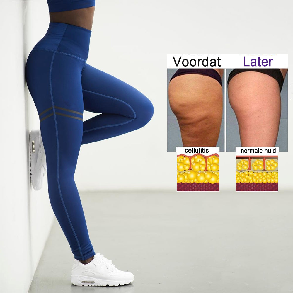 EB | Cellulite Kompressionsleggings für Frauen